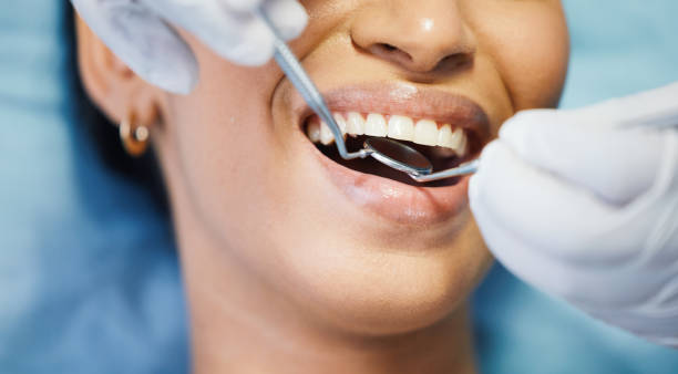 Best Emergency Dental Care for Abscessed Tooth in Monmouth, OR