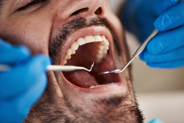Fast & Reliable Emergency Dental Services in OR
